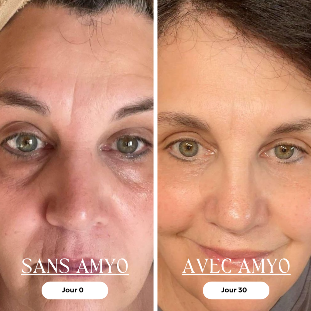 AMYO Masque LED Anti-Âge Lumière Rouge