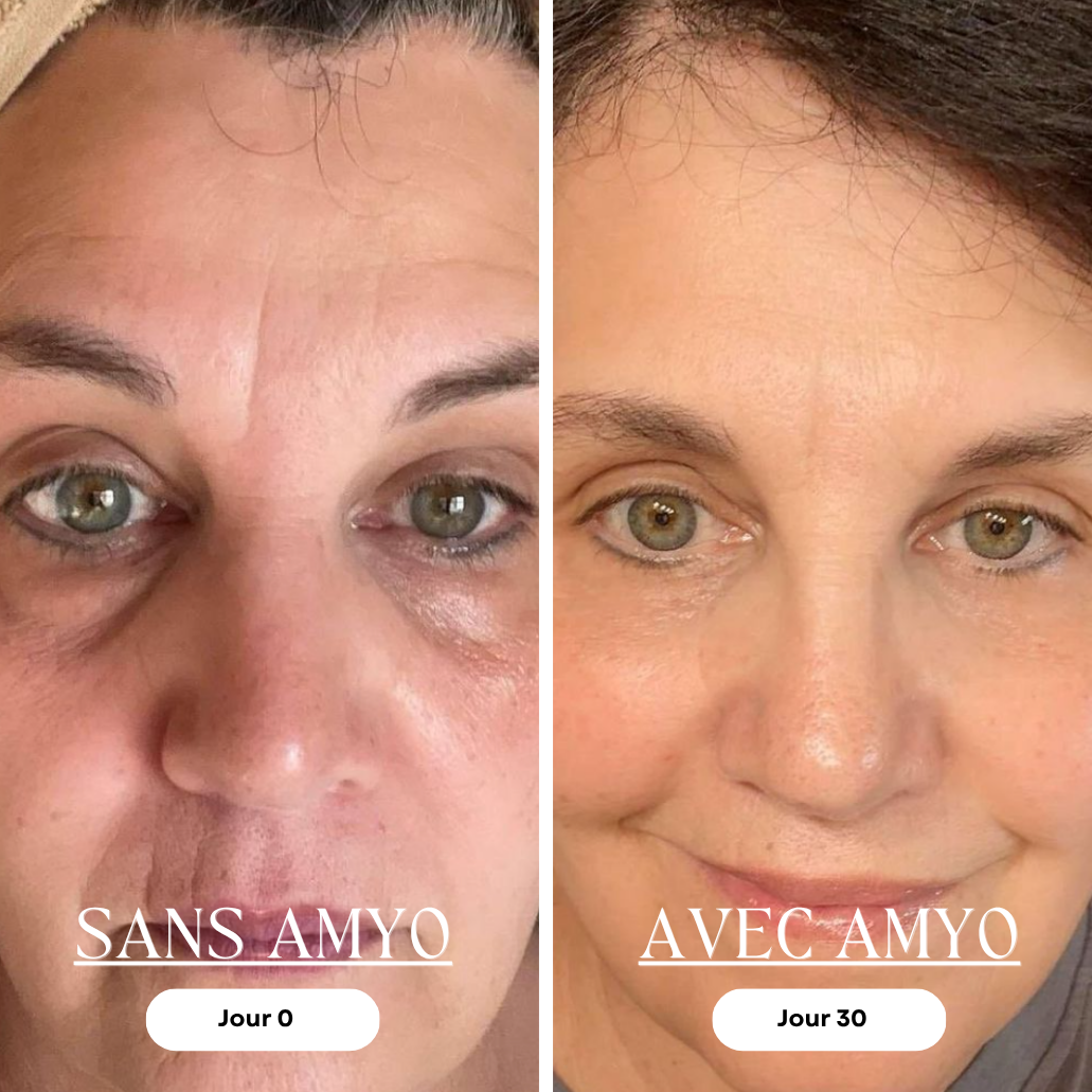 AMYO Masque LED Anti-Âge Lumière Rouge