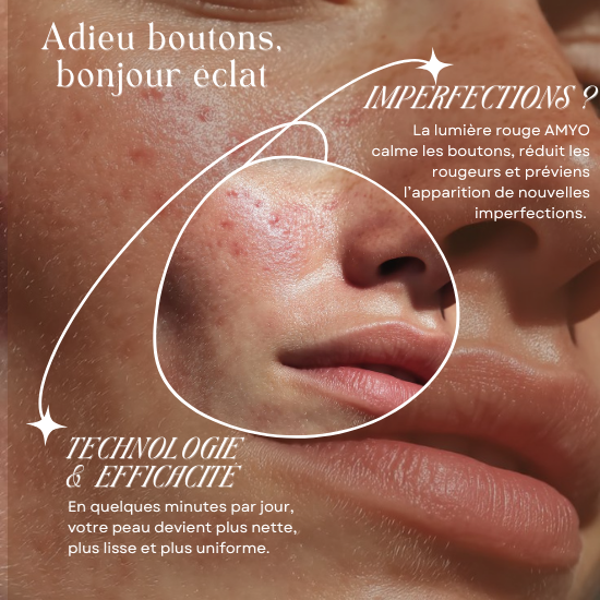 AMYO Masque LED Anti-Âge Lumière Rouge