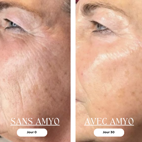 AMYO Masque LED Anti-Âge Lumière Rouge