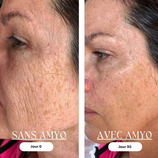 AMYO Masque LED Anti-Âge Lumière Rouge