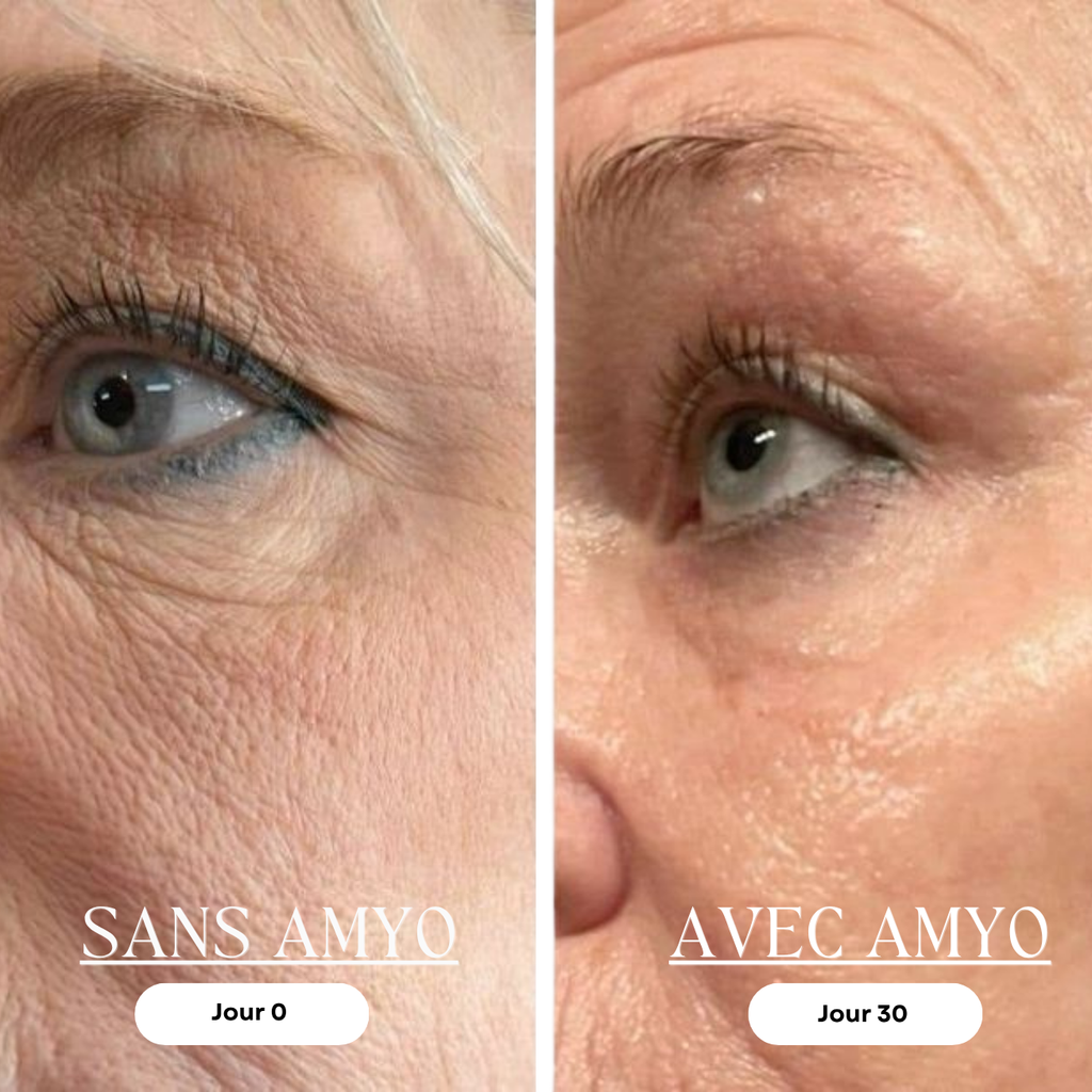 AMYO Masque LED Anti-Âge Lumière Rouge