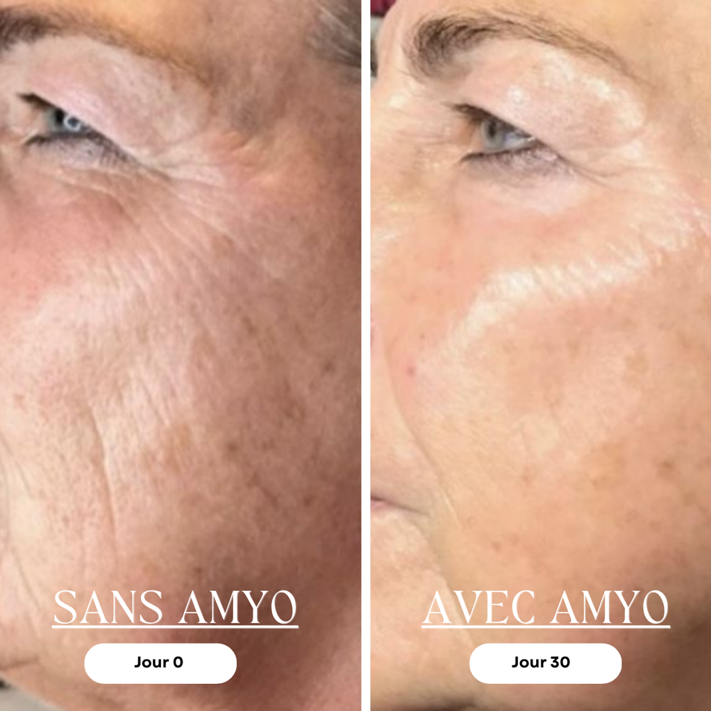 AMYO Masque LED Anti-Âge Lumière Rouge