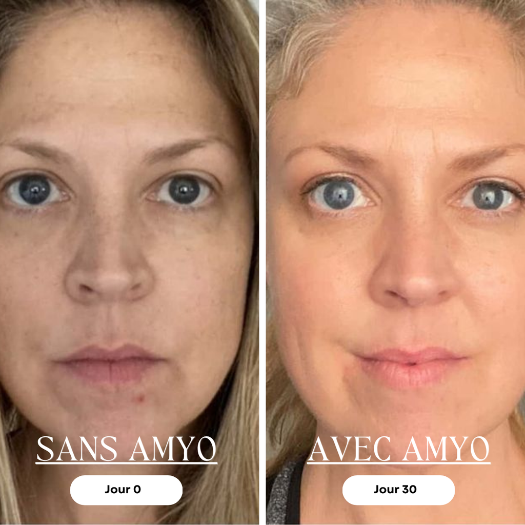 AMYO Masque LED Anti-Âge Lumière Rouge